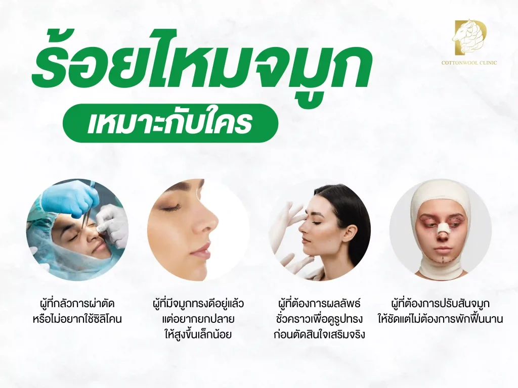 ร้อยไหมจมูก เหมาะกับใคร