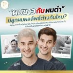 ผมขาวกับผมดำปลูกผมผลลัพธ์ต่างกันไหม?