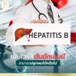 เป็นไวรัสตับอักเสบบีปลูกผมได้หรือไม่