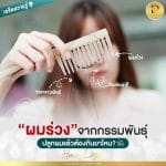 ผมร่วงจากกรรมพันธุ์ ปลูกผมแล้วต้องกินยาไหม?