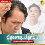 ผู้สูงอายุปลูกผม ผลลัพธ์จะเหมือนวัยรุ่นไหม?
