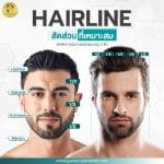 Hairline สัดส่วนที่เหมาะสม