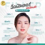 ฉีดฟิลเลอร์ตรงไหนดี ช่วยเสริมใบหน้า