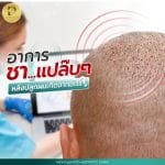 อาการชาแปล๊บ ๆ หลังปลูกผมเกิดจากอะไร