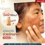 ฉีดฝ้าดีไหม ?