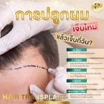 การปลูกผมเจ็บไหม แล้วเจ็บกี่วัน?