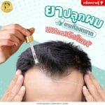 ยาปลูกผมตามท้องตลาดใช้ได้ผลจริงไหม?
