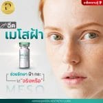 ฉีดเมโสฝ้า ช่วยรักษาฝ้า กระได้จริงหรือ ?