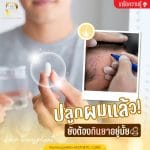 ปลูกผมแล้วยังต้องกินยาอยู่มั้ย