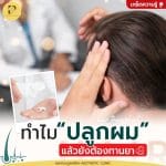 ทำไมปลูกผมแล้วยังต้องทานยา