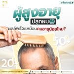 ผู้สูงอายุปลูกผม ผลลัพธ์จะเหมือนคนอายุน้อยไหม? (Elderly people do the hair transplant will the results be the same as younger people?)