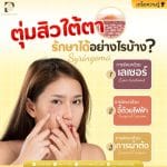 ตุ่มสิวใต้ตา รักษาได้อย่างไรบ้าง