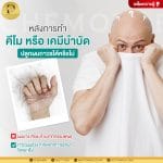 หลังทำคีโมหรือเคมีบำบัดสามารถปลูกผมถาวรได้หรือไม่