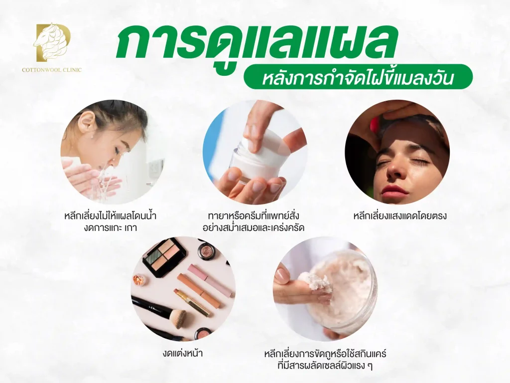 การดูแลแผลหลังการกำจัดไฝขี้แมลงวัน