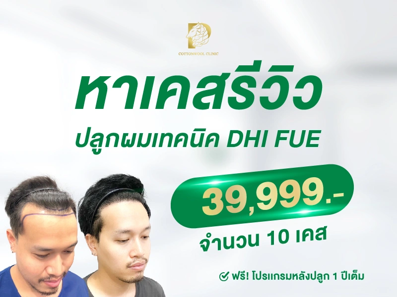 คลินิคปลูกผมราคาถูก