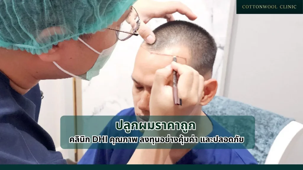 ปลูกผมราคาถูก คลินิก DHI