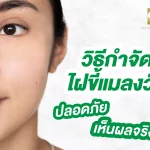 วิธีกําจัดไฝขี้แมลงวัน อย่างปลอดภัย และเห็นผลจริง