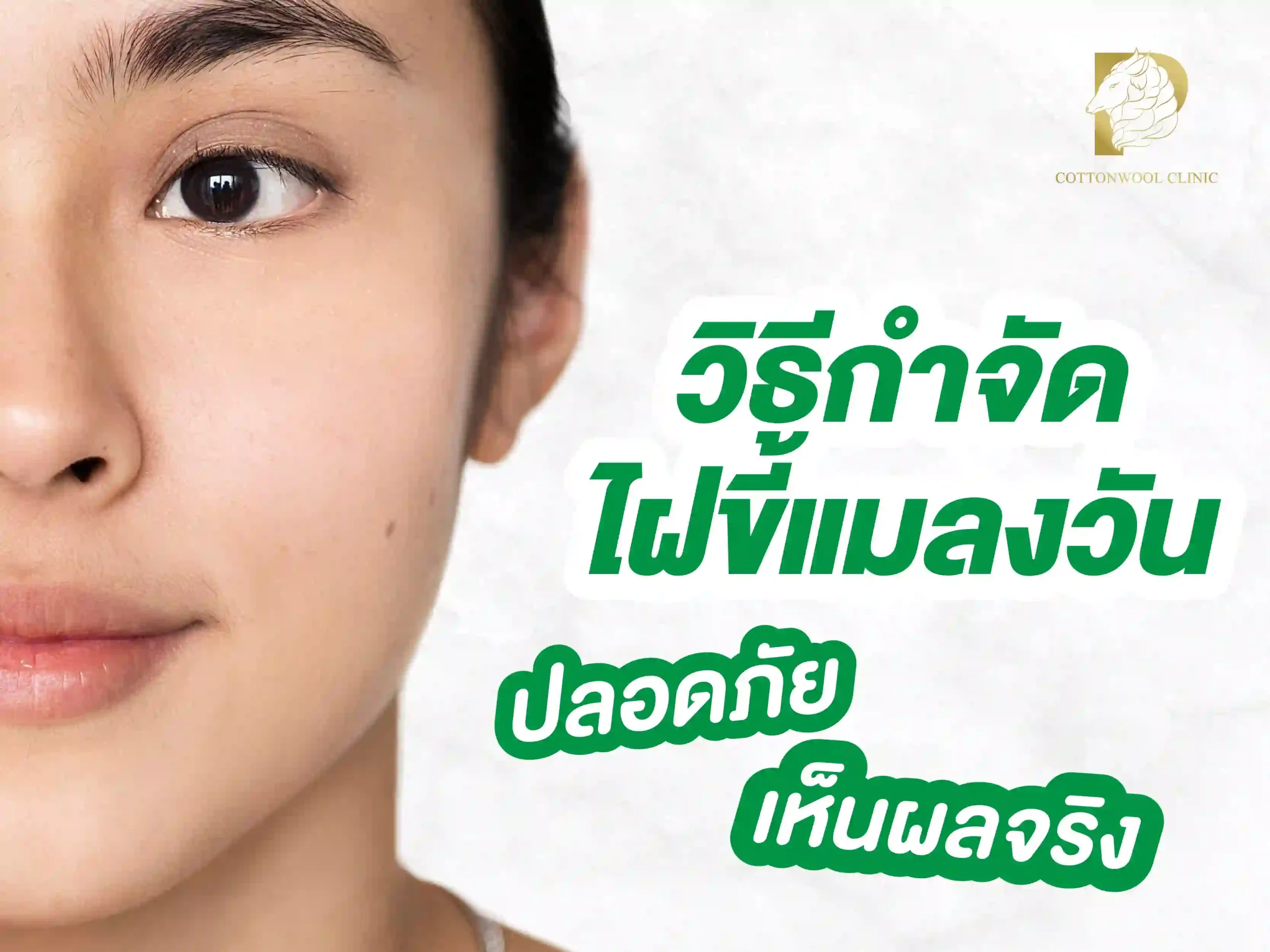 วิธีกําจัดไฝขี้แมลงวัน