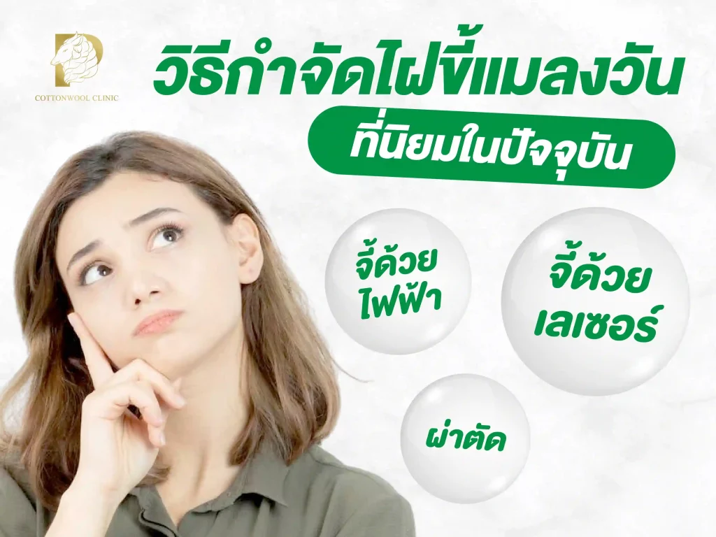 วิธีกําจัดไฝขี้แมลงวัน ที่นิยมในปัจจุบัน