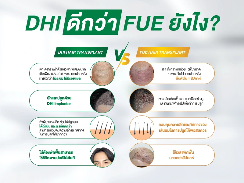 วิธีเลือกคลินิกปลูกผม DHI