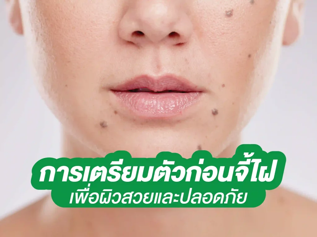 เตรียมตัวก่อนจี้ไฝ