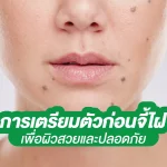 การเตรียมตัวก่อนจี้ไฝ เพื่อผิวสวยและปลอดภัย