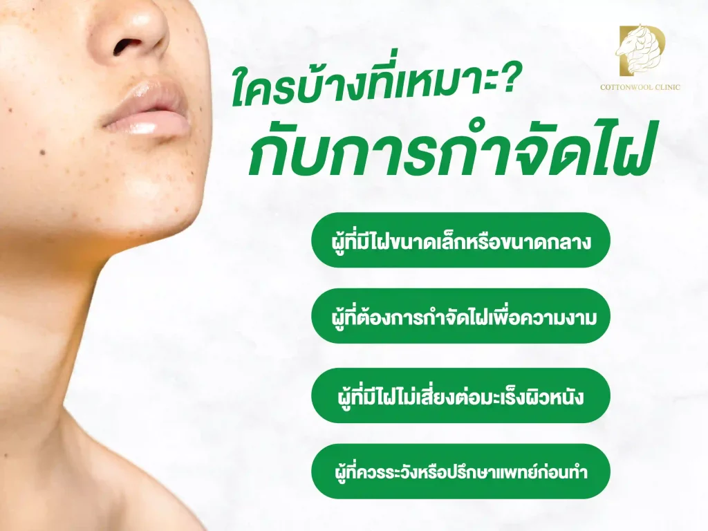 ใครบ้างที่เหมาะกับการกำจัดไฝ