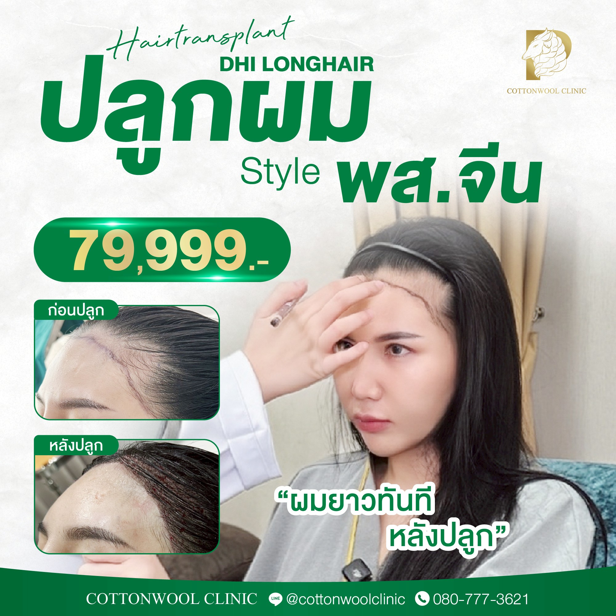 LINE_ALBUM_งาน Add ปลูกผม_250822_106