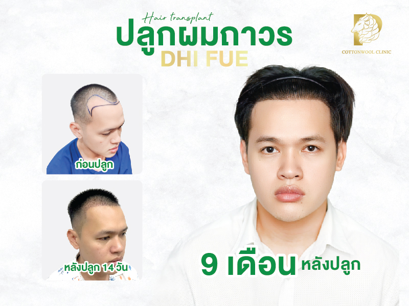 Review section_1