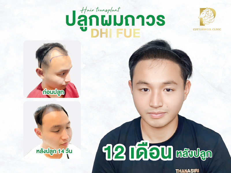 Review section_4
