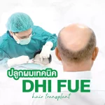 ปลูกผมเทคนิค DHI คืออะไร? ข้อดี ราคา และขั้นตอนที่คุณควรรู้