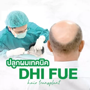 ปลูกผมเทคนิค DHI