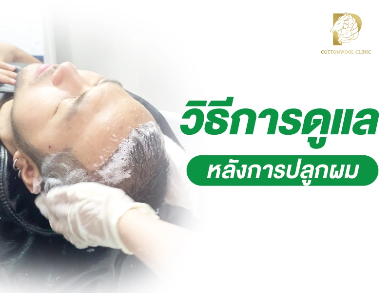 การดูแลตัวเองหลังปลูกผมแบบ DHI