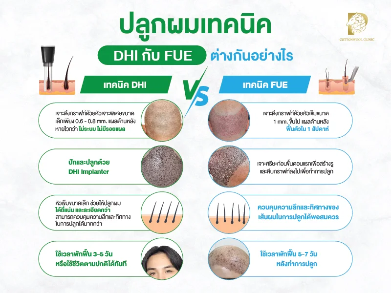 ปลูกผม FUE กับ DHI ต่างกันอย่างไร