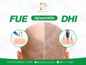 ปลูกผมแบบ FUE และ DHI เปรียบเทียบความแตกต่างของเทคนิคการย้ายกราฟต์ผม
