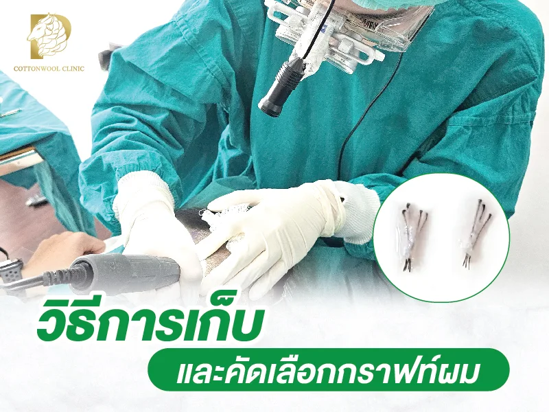 วิธีการเก็บและคัดเลือกกราฟท์เส้นผม