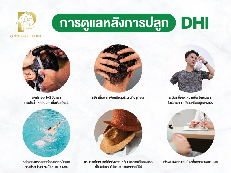 หลังปลูกผม DHI ต้องทำยังไง