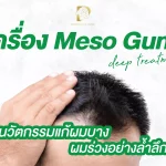 เครื่อง Meso Gun deep treatment นวัตกรรมแก้ผมบาง ผมร่วงอย่างล้ำลึก
