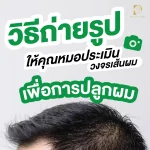 วิธีถ่ายรูปเพื่อให้คุณหมอประเมินวงจรเส้นผม เพื่อการปลูกผมได้อย่างแม่นยำ